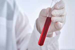 Test tube with blood in the hand.